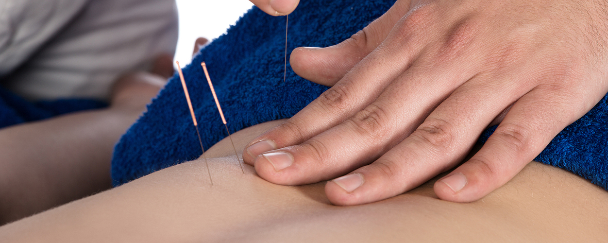 Integrative Dry Needling